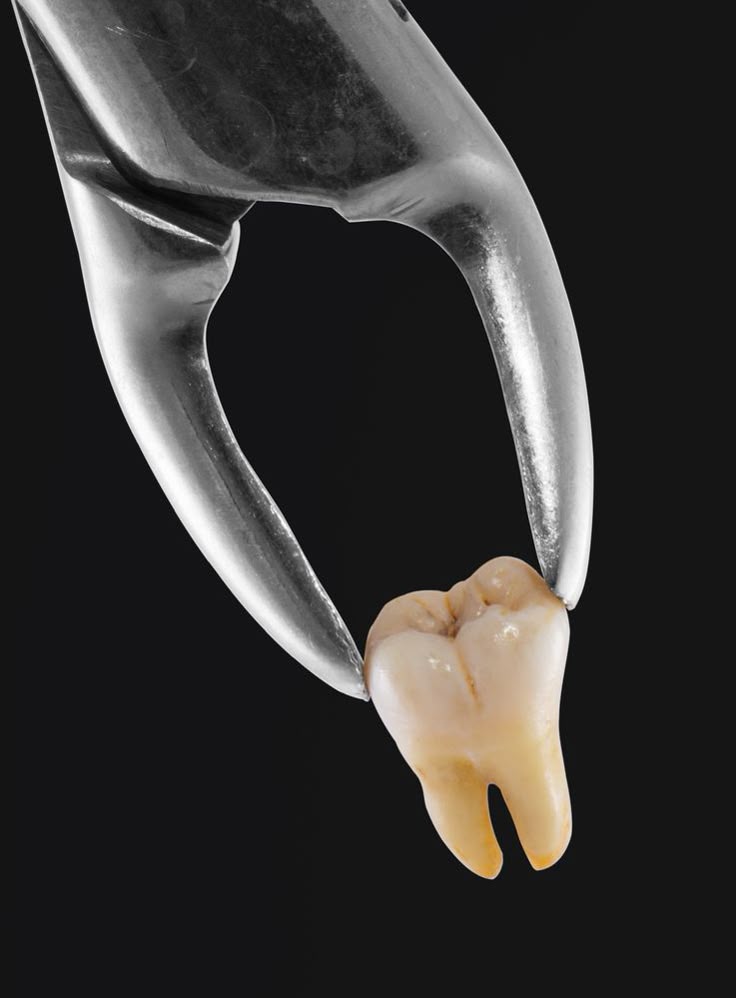 Oral Surgery